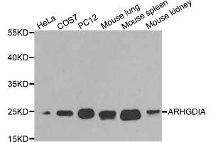 Western blot analysis of extracts of various cell lines, using ARHGDIA antibody (ABIN5970556) at 1/1000 dilution. (ARHGDIA anticorps)