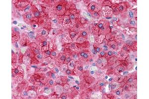 ApoE antibody was used for immunohistochemistry at a concentration of 4-8 ug/ml. (APOE anticorps  (N-Term))