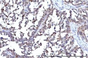 IHC analysis of RANBP2 using anti-RANBP2 antibody (ABIN7602650). (RANBP2 anticorps  (AA 906-2744))