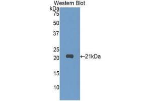 Western blot analysis of the recombinant protein. (SIGLEC10 anticorps  (AA 571-697))