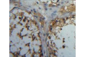 Used in DAB staining on fromalin fixed paraffin-embedded testis tissue