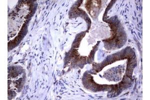 Image no. 1 for anti-Sialidase 1 (Lysosomal Sialidase) (NEU1) (AA 48-315) antibody (ABIN1491548)