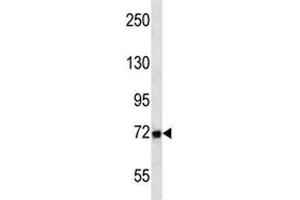MMP2 antibody western blot analysis in T47D lysate.