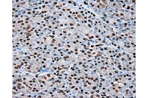 Immunohistochemical staining of paraffin-embedded lung tissue using anti-DAPK2 mouse monoclonal antibody.