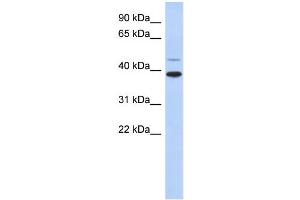 WB Suggested Anti-RNF121 Antibody Titration:  0. (RNF121 anticorps  (Middle Region))