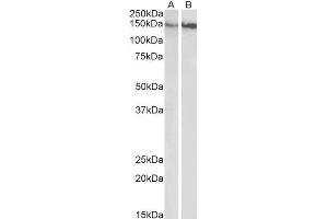 ABIN5539624 (0. (ITGB1 anticorps  (Internal Region))