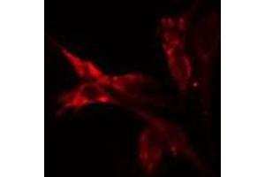 ABIN6275501 staining HeLa cells by IF/ICC. (ARHGEF2 anticorps  (C-Term))