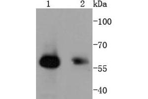 Lane 1: Human skeletal muscle, Lane 2: Hela, probed with HDAC2 (3B7) Monoclonal Antibody  at 1:1000 overnight at 4˚C. (SMAD1 anticorps)