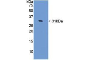 Western blot analysis of recombinant Human CENPI. (CENPI anticorps  (AA 292-528))