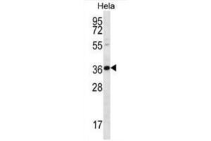 BTG3 Antibody (Center) western blot analysis in Hela cell line lysates (35ug/lane).