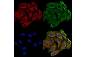 ABIN7094247 and ABIN7098294 staining Hela cells by IF/ICC. (GALNT14 anticorps  (N-Term))