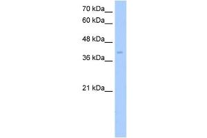 ZDHHC17 antibody used at 5 ug/ml to detect target protein. (ZDHHC17 anticorps  (Middle Region))