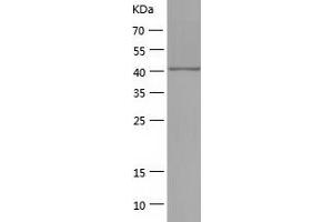 Western Blotting (WB) image for phosphoribosylaminoimidazole Carboxylase, phosphoribosylaminoimidazole Succinocarboxamide Synthetase (PAICS) (AA 1-425) protein (His tag) (ABIN7124444)