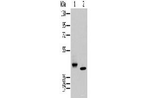 Western blot analysis of Human fetal brain tissue and Human kidney tissue using IDO2 Polyclonal Antibody at dilution of 1:450 (IDO2 anticorps)