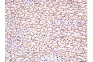 Formalin-fixed and paraffin embedded rat kidney tissue labeled with Rabbit Anti-DCTN5 Polyclonal Antibody, Unconjugated  at 1:200 followed by conjugation to the secondary antibody and DAB staining