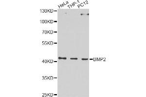 Western blot analysis of extracts of various cell lines, using BMP2 Antibody. (BMP2 anticorps)