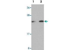 Western blot analysis of Raji cells with LIN28 polyclonal antibody  at (Lane 1) 1 and (Lane 2) 2 ug/mL dilution. (LIN28A anticorps  (C-Term))