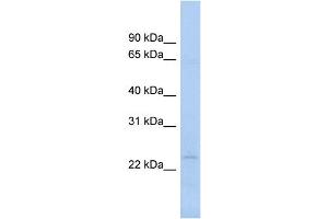WB Suggested Anti-NAT9 Antibody Titration:  0. (NAT9 anticorps  (N-Term))