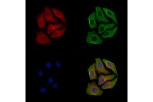 Phospho-GAP43 (Ser41) Antibody staining Hela cells(heat shock treatment) by IF/ICC. (GAP43 anticorps  (pSer41))