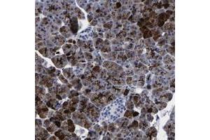 Immunohistochemical staining of human pancreas with IER5L polyclonal antibody  shows strong cytoplasmic positivity in exocrine cells.