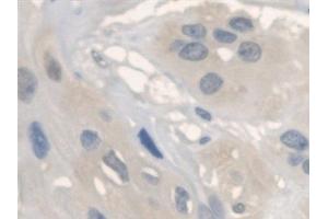 Detection of ANTXR2 in Human Esophagus Tissue using Polyclonal Antibody to Anthrax Toxin Receptor 2 (ANTXR2)