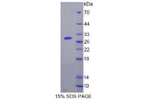 SDS-PAGE analysis of Mouse GCPII Protein. (PSMA Protéine)