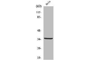 Western Blot analysis of HeLa cells using Cleaved-Cathepsin L2 (L114) Polyclonal Antibody (Cathepsin L2 anticorps  (Cleaved-Leu114))