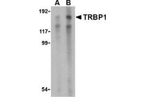 Western blot analysis of TRBP1 in 3T3 cell lysate with this product at (A) 1 and (B) 2 μg/ml. (TARBP1 anticorps  (Center))