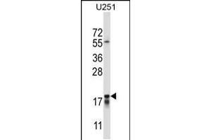 Western blot analysis in U251 cell line lysates (35ug/lane). (CTAG2 anticorps  (AA 122-149))