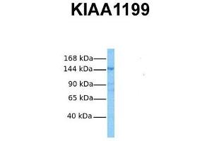 Host:  Rabbit  Target Name:  KIAA1199  Sample Tissue:  Human OVCAR-3  Antibody Dilution:  1. (CEMIP anticorps  (Middle Region))