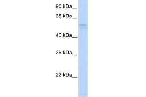 WB Suggested Anti-TRIM39 Antibody Titration:  0.