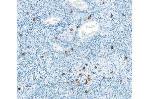 Immunohistochemistry (IHC) image for anti-Granzyme B (GZMB) (AA 19-247) antibody (ABIN7449554) (Recombinant GZMB anticorps  (AA 19-247))