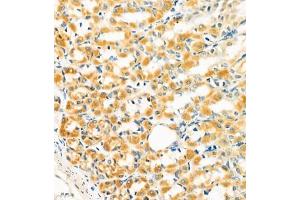 Immunohistochemistry of paraffin embedded rat gastritis using GRASP (ABIN7074140) at dilution of 1:400 (400x lens)