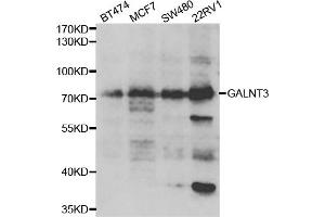 Western blot analysis of extracts of various cell lines, using GALNT3 antibody. (GALNT3 anticorps)