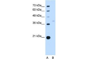 WB Suggested Anti-RFC3 Antibody Titration:  0. (RFC3 anticorps  (N-Term))