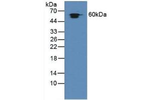 Detection of Hsp60 in Rat Liver Tissue using Polyclonal Antibody to Heat Shock Protein 60 (Hsp60)