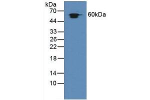 Detection of Hsp60 in Rat Liver Tissue using Polyclonal Antibody to Heat Shock Protein 60 (Hsp60) (HSPD1 anticorps  (AA 172-343))