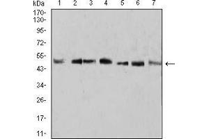 Western blot analysis using KLF2 mouse mAb against A431 (1), U937 (2), NIH/3T3 (3), Raw264.