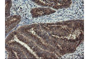 Image no. 5 for anti-Acyl-CoA Binding Domain Containing 3 (Acbd3) antibody (ABIN1498415)