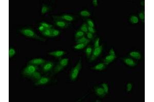 Immunofluorescent analysis of Hela cells using ABIN7156029 at dilution of 1:100 and Alexa Fluor 488-congugated AffiniPure Goat Anti-Rabbit IgG(H+L)