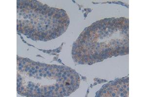 Used in DAB staining on fromalin fixed paraffin- embedded Kidney tissue