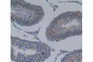 Used in DAB staining on fromalin fixed paraffin- embedded Kidney tissue (SPA17 anticorps  (AA 1-140))