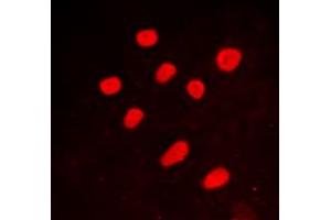 Immunofluorescent analysis of CTBP2 staining in A549 cells. (CTBP2 anticorps  (C-Term))