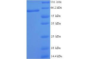SDS-PAGE (SDS) image for NCK Adaptor Protein 2 (NCK2) (AA 1-380), (full length) protein (His-SUMO Tag) (ABIN5709993) (NCK2 Protein (AA 1-380, full length) (His-SUMO Tag))
