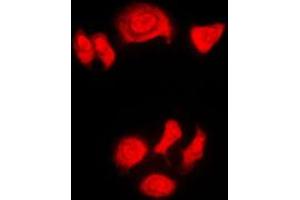Immunofluorescent analysis of Nucleophosmin (pT199) staining in HeLa cells.