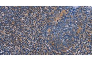 Immunohistochemistry of paraffin-embedded Human tonsil using AGFG1 Polyclonal Antibody at dilution of 1:60 (AGFG1 anticorps)