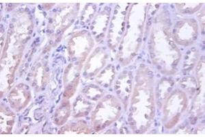Immunohistochemistry of paraffin-embedded human kidney using TNFRSF10D / TRAIL-R4 / DCR2 antibody at dilution of 1:100. (DcR2 anticorps  (FITC))