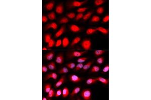 Immunofluorescence analysis of U20S cell using ZEB1 antibody. (ZEB1 anticorps)