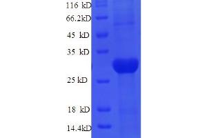 SDS-PAGE (SDS) image for S100 Calcium Binding Protein A9 (S100A9) (AA 2-113) protein (His-SUMO Tag) (ABIN5710304)