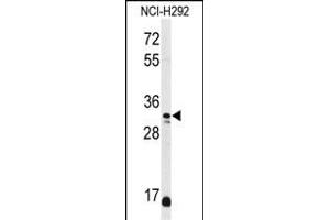 Western blot analysis of DDO Antibody (Center) (ABIN650991 and ABIN2840026) in NCI- cell line lysates (35 μg/lane). (DDO anticorps  (AA 102-130))